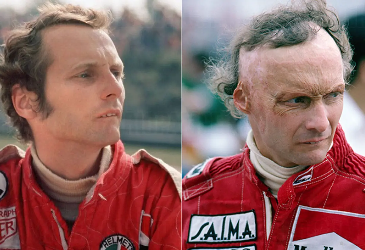 niki_lauda