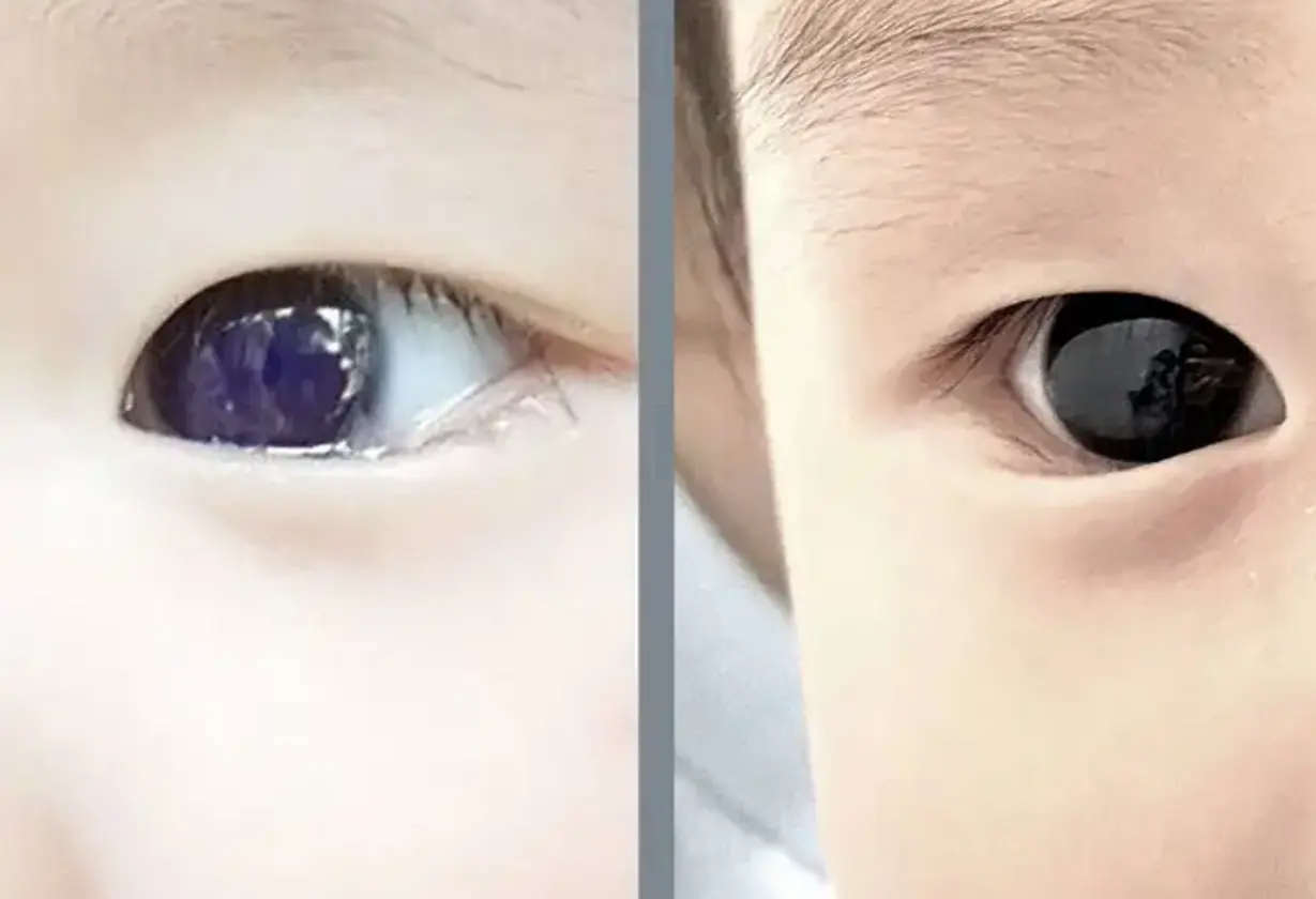 ojos