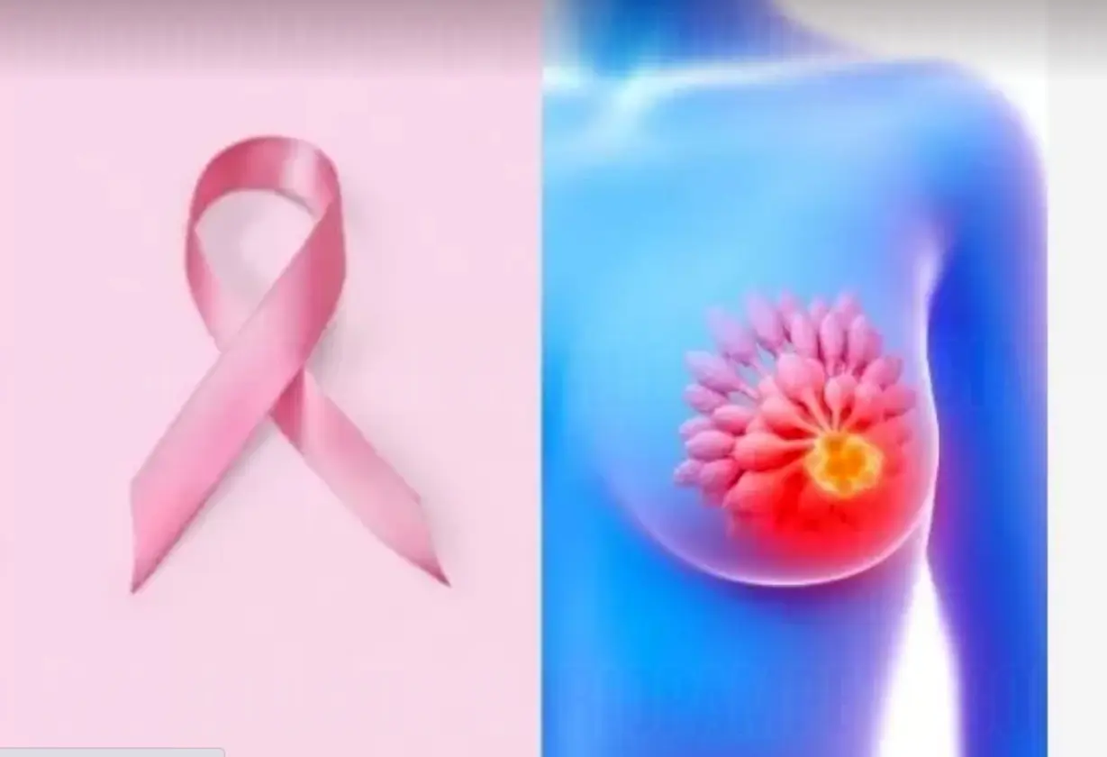 cancer_mama