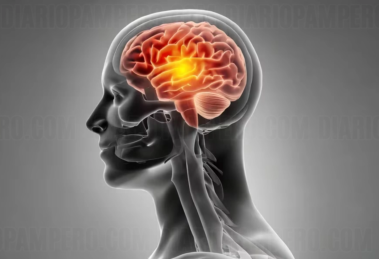 alzheimer