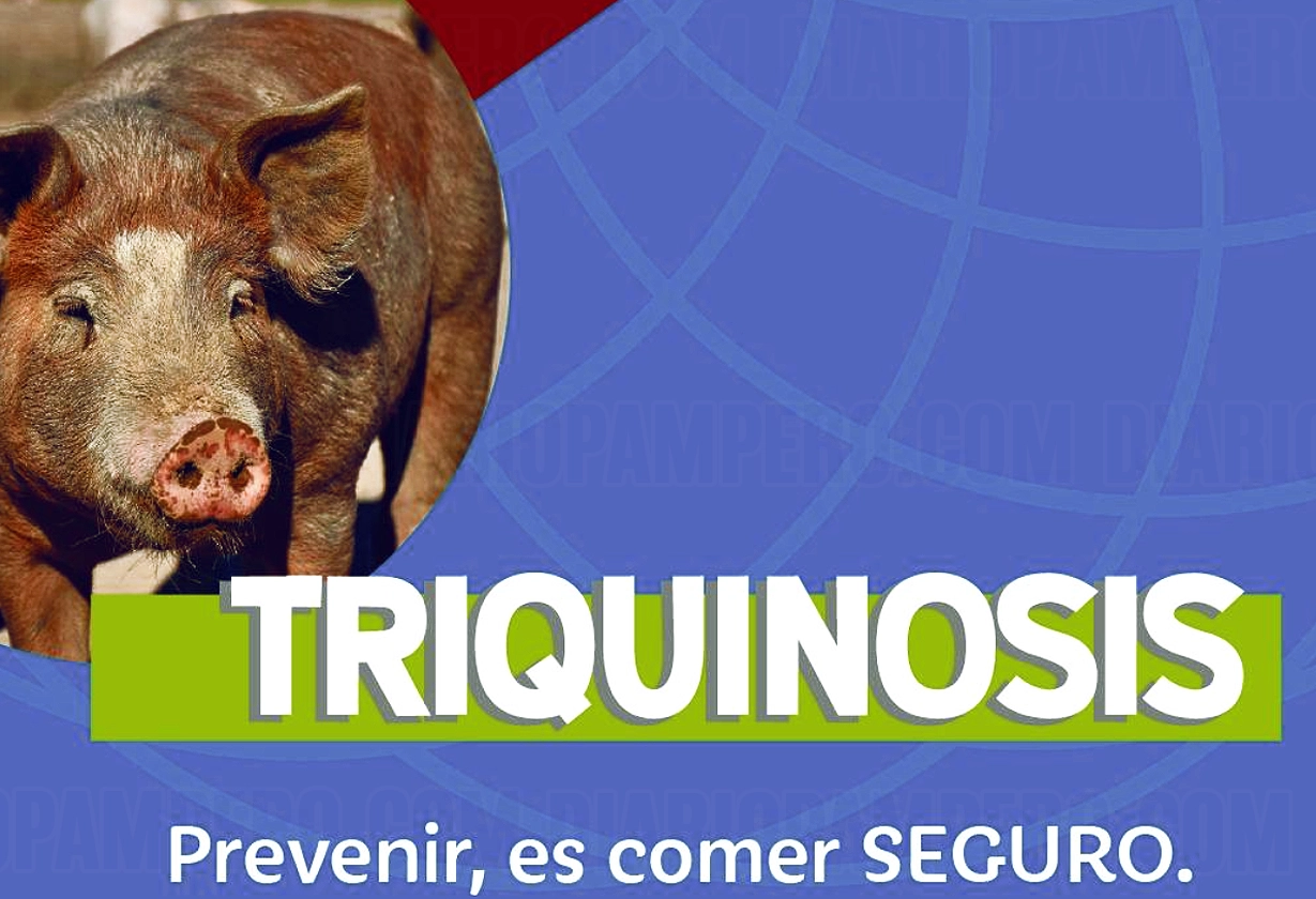 triquinosis_apn