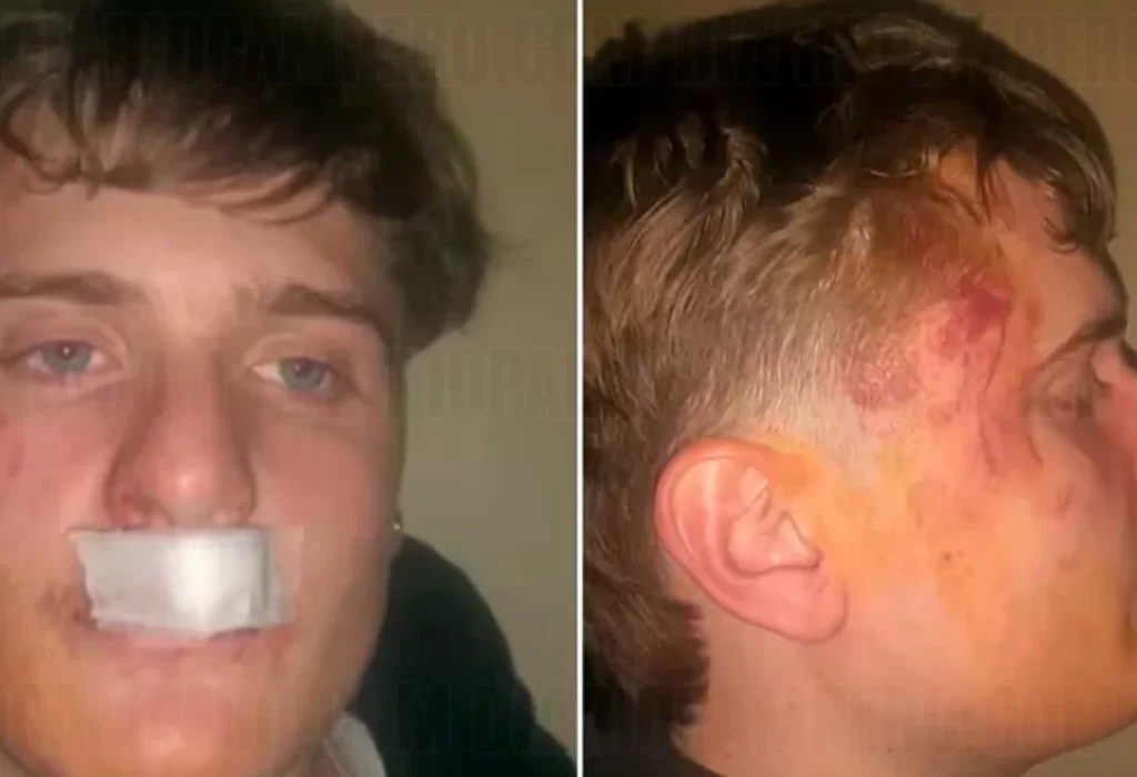 Brutal Ataque de Rugbiers a Joven en Fiesta de Zárate: Patadas en la Boca y Sien