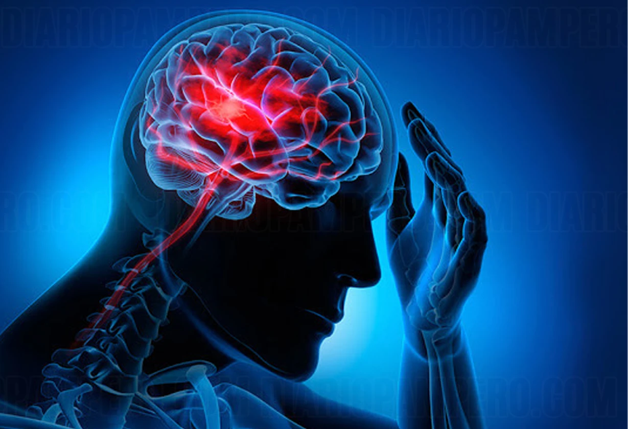 neurologica