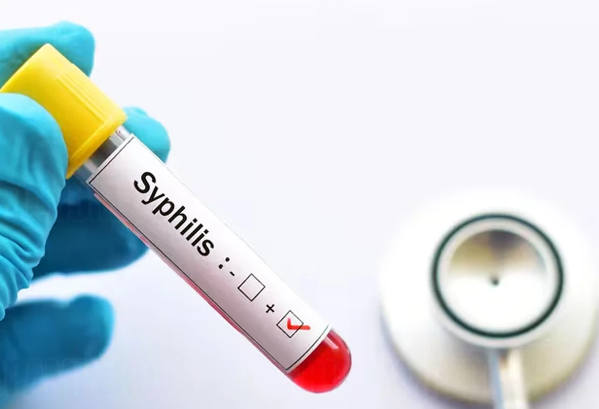 sifilis