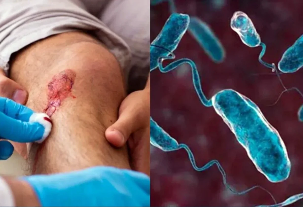 bacteria
