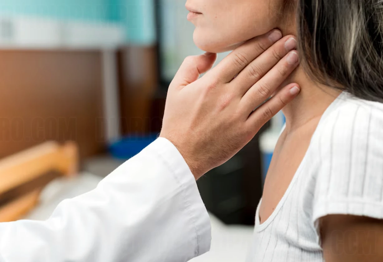 mononucleosis
