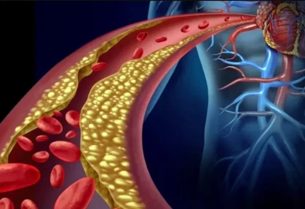 Colesterol Alto: 3 Cambios Simples en la Alimentación para Reducirlo Eficazmente