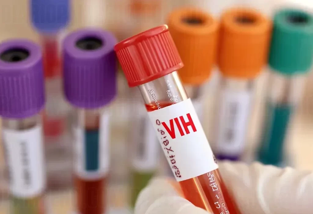 El 45% de los diagnósticos de VIH en Argentina son tardíos
