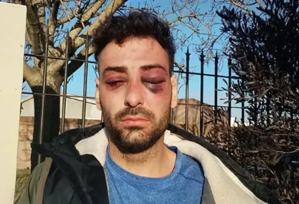 Formalizarán a siete policías por la agresión a Lautaro Ruiz