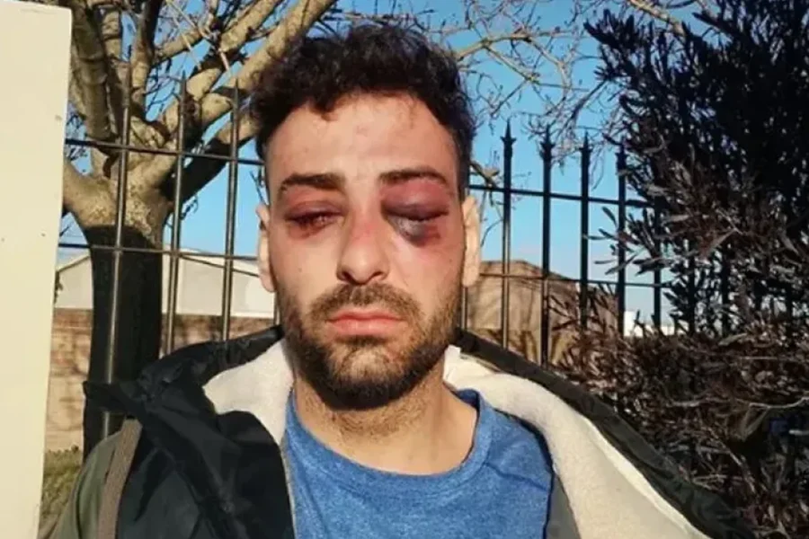 Formalizarán a siete policías por la agresión a Lautaro Ruiz